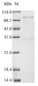 Recombinant Human Deformed epidermal autoregulatory factor 1 homolog(DEAF1)