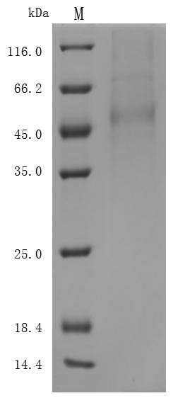 Recombinant Human Delta-like protein 3(DLL3),partial (Active)