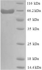Recombinant Human Delta-like protein 3(DLL3),partial