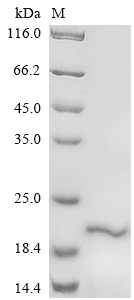 Recombinant Human Delta-like protein 3(DLL3),partial