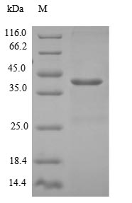 Recombinant Human Density-regulated protein(DENR)