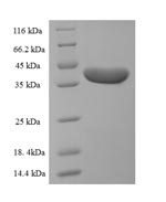 Recombinant Human Desmoplakin(DSP) ,partial