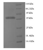 Recombinant Human Dihydrofolate reductase(DHFR)