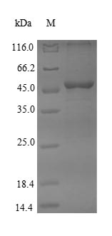 Recombinant Human Dihydroorotate dehydrogenase (quinone),mitochondrial(DHODH),partial
