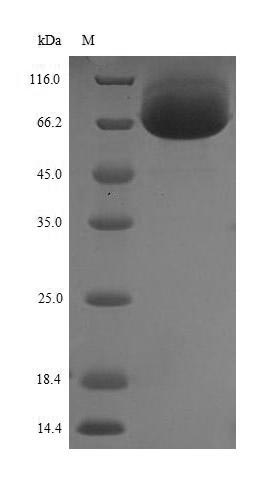 Recombinant Human Dihydropyrimidinase-related protein 5(DPYSL5)