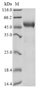 Recombinant Human Disco-interacting protein 2 homolog A(DIP2A),partial