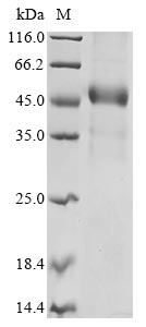 Recombinant Human Disco-interacting protein 2 homolog C(DIP2C),partial
