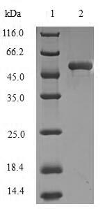 Recombinant Human Dynactin subunit 1(DCTN1),partial
