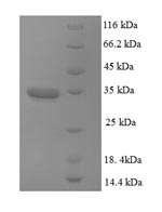 Recombinant Human Dynactin subunit 3(DCTN3)