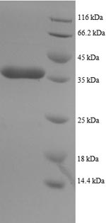 Recombinant Human Dynein light chain 1, Cytoplasmic domain(DYNLL1)