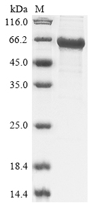 Recombinant Human E3 ubiquitin-protein ligase RNF8(RNF8)
