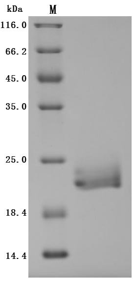Recombinant Human E3 ubiquitin-protein ligase ZNRF3(ZNRF3),partial (Active)