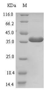 Recombinant Human E3 ubiquitin-protein ligase ZNRF3(ZNRF3),partial