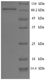 Recombinant Human E3 ubiquitin-protein ligase parkin(PRKN)