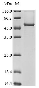 Recombinant Human EF-hand calcium-binding domain-containing protein 4A(CRACR2B)