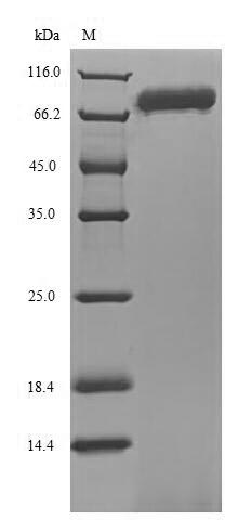 Recombinant Human Ecto-NOX disulfide-thiol exchanger 1(ENOX1)