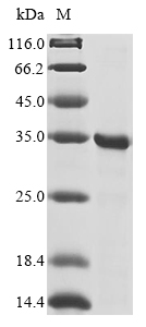 Recombinant Human Egl nine homolog 1(EGLN1),partial