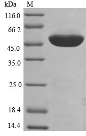 Recombinant Human Elongation factor 1-alpha 1(EEF1A1)
