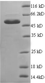 Recombinant Human Endoplasmic reticulum resident protein 29(ERP29),partial