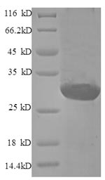 Recombinant Human Endothelin-1(EDN1) (Active)