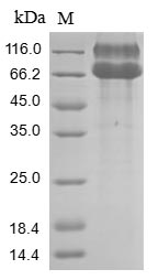 Recombinant Human Ephrin type-A receptor 2(EPHA2),partial