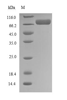 Recombinant Human Ephrin type-A receptor 3(EPHA3),partial (Active)
