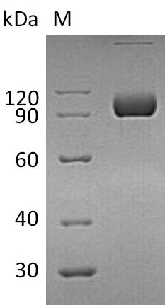 Recombinant Human Ephrin type-A receptor 4(EPHA4),partial (Active)