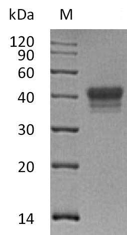 Recombinant Human Ephrin type-B receptor 1(EPHB1),partial (Active)