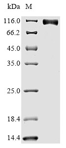 Recombinant Human Epidermal growth factor receptor(EGFR),partial (Active)