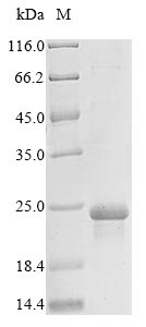 Recombinant Human Epidermal growth factor receptor(EGFR),partial