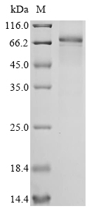 Recombinant Human Epidermal growth factor receptor(EGFR),partial