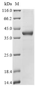 Recombinant Human Epididymal secretory glutathione peroxidase(GPX5)