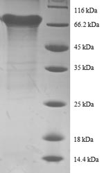 Recombinant Human Eukaryotic initiation factor 4A-II(EIF4A2)