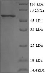 Recombinant Human Eukaryotic translation initiation factor 3 subunit G(EIF3G)
