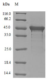 Recombinant Human Eukaryotic translation initiation factor 4 gamma 1(EIF4G1),partial