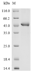 Recombinant Human Extracellular matrix protein 1(ECM1),partial