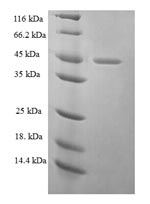 Recombinant Human Ezrin(EZR),partial