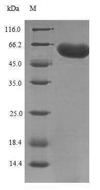 Recombinant Human F-box/LRR-repeat protein 2(FBXL2)