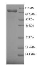 Recombinant Human Fanconi anemia group C protein(FANCC)