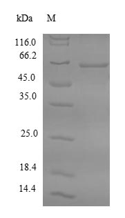 Recombinant Human Farnesyl pyrophosphate synthase(FDPS)