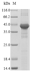 Recombinant Human Fatty acid synthase(FASN),partial
