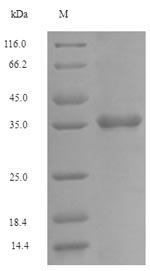 Recombinant Human Fc receptor-like protein 6(FCRL6),partial