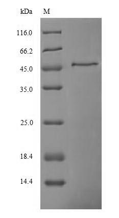 Recombinant Human Ferritin heavy chain(FTH1)