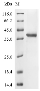 Recombinant Human Fibrillin-1(FBN1),partial