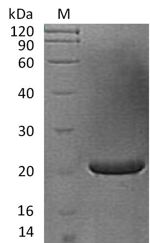 Recombinant Human Fibroblast growth factor 17(FGF17) (Active)