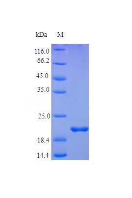 Recombinant Human Fibroblast growth factor 19(FGF19),partial(Active)