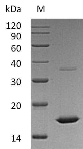 Recombinant Human Fibroblast growth factor 2(FGF2) (Active)