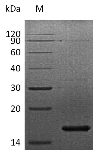 Recombinant Human Fibroblast growth factor 7(FGF7) (Active)