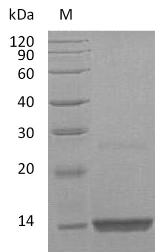Recombinant Human Fibroblast growth factor 9(FGF9) (Active)