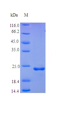 Recombinant Human Fibroblast growth factor 9 protein(FGF9) (Active)